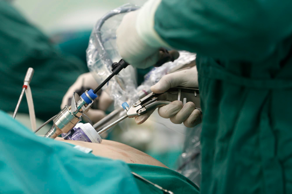 Dr y satish Reddy, laparoscopic and Robotic surgeon